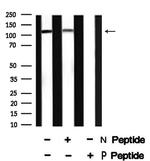 Phospho-USP28 (Ser67) Antibody in Western Blot (WB)