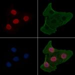 Phospho-USP28 (Ser714) Antibody in Immunocytochemistry (ICC/IF)