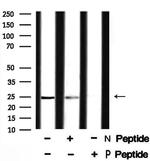 Phospho-VHL (Ser68) Antibody in Western Blot (WB)