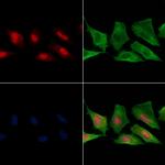 Phospho-VHL (Ser68) Antibody in Immunocytochemistry (ICC/IF)