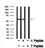 Phospho-PFKFB2 (Ser466) Antibody in Western Blot (WB)