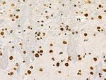 Phospho-POLR2A (Ser1616) Antibody in Immunohistochemistry (Paraffin) (IHC (P))