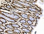 Phospho-POLR2A (Ser1616) Antibody in Immunohistochemistry (Paraffin) (IHC (P))