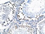 Phospho-POLR2A (Ser1616) Antibody in Immunohistochemistry (Paraffin) (IHC (P))