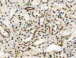 Phospho-POLR2A (Ser1616) Antibody in Immunohistochemistry (Paraffin) (IHC (P))