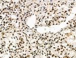 Phospho-POLR2A (Ser1616) Antibody in Immunohistochemistry (Paraffin) (IHC (P))