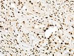 Phospho-POLR2A (Ser1616) Antibody in Immunohistochemistry (Paraffin) (IHC (P))