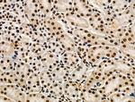 Phospho-POLR2A (Ser1616) Antibody in Immunohistochemistry (Paraffin) (IHC (P))