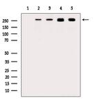 Phospho-POLR2A (Ser1616) Antibody in Western Blot (WB)