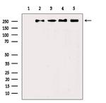 Phospho-POLR2A (Ser1616) Antibody in Western Blot (WB)