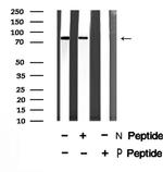 Phospho-Btk (Ser179) Antibody in Western Blot (WB)