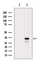 Phospho-CDK5 (Ser159) Antibody in Western Blot (WB)