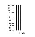 Phospho-CDK5 (Ser159) Antibody in Western Blot (WB)