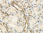 Phospho-E2F1 (Ser364) Antibody in Immunohistochemistry (Paraffin) (IHC (P))