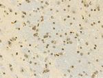 Phospho-E2F1 (Ser364) Antibody in Immunohistochemistry (Paraffin) (IHC (P))