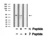 Phospho-E2F1 (Ser364) Antibody in Western Blot (WB)