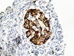 Phospho-IRS2 (Ser1100) Antibody in Immunohistochemistry (Paraffin) (IHC (P))