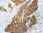 Phospho-ITGB1 (Tyr783) Antibody in Immunohistochemistry (Paraffin) (IHC (P))