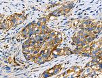 Phospho-ITGB1 (Tyr783) Antibody in Immunohistochemistry (Paraffin) (IHC (P))