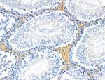 Phospho-PLCG1 (Ser1248) Antibody in Immunohistochemistry (Paraffin) (IHC (P))