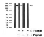 Phospho-PLCG1 (Ser1248) Antibody in Western Blot (WB)