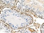 Phospho-PRC1 (Thr481) Antibody in Immunohistochemistry (Paraffin) (IHC (P))