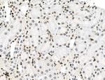 Phospho-PRC1 (Thr481) Antibody in Immunohistochemistry (Paraffin) (IHC (P))