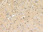 Phospho-PRC1 (Thr481) Antibody in Immunohistochemistry (Paraffin) (IHC (P))