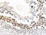 Phospho-PRC1 (Thr481) Antibody in Immunohistochemistry (Paraffin) (IHC (P))