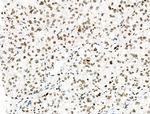 Phospho-PRC1 (Thr481) Antibody in Immunohistochemistry (Paraffin) (IHC (P))