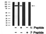 Phospho-Rb (Thr373) Antibody in Western Blot (WB)