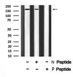 Phospho-ROCK2 (Tyr722) Antibody in Western Blot (WB)