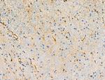 Phospho-ROCK2 (Tyr722) Antibody in Immunohistochemistry (Paraffin) (IHC (P))