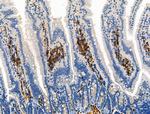 Phospho-ROCK2 (Tyr722) Antibody in Immunohistochemistry (Paraffin) (IHC (P))