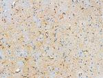 Phospho-ROCK2 (Tyr722) Antibody in Immunohistochemistry (Paraffin) (IHC (P))