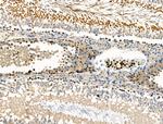 Phospho-Androgen Receptor (Ser792) Antibody in Immunohistochemistry (Paraffin) (IHC (P))