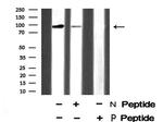 Phospho-Androgen Receptor (Ser792) Antibody in Western Blot (WB)