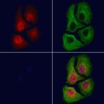 Phospho-Androgen Receptor (Ser310) Antibody in Immunocytochemistry (ICC/IF)