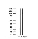 Phospho-Androgen Receptor (Ser310) Antibody in Western Blot (WB)