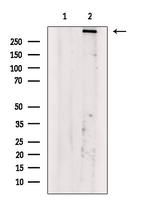 Phospho-ATM (Ser794) Antibody in Western Blot (WB)