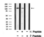 Phospho-EphA1 (Tyr781) Antibody in Western Blot (WB)