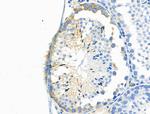 Phospho-EphB6 (Tyr645) Antibody in Immunohistochemistry (Paraffin) (IHC (P))