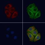 Phospho-EphB6 (Tyr645) Antibody in Immunocytochemistry (ICC/IF)