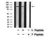 Phospho-EphB6 (Tyr645) Antibody in Western Blot (WB)