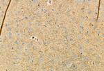 Phospho-FGFR2 (Ser782) Antibody in Immunohistochemistry (Paraffin) (IHC (P))