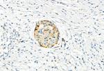 Phospho-FGFR2 (Ser782) Antibody in Immunohistochemistry (Paraffin) (IHC (P))