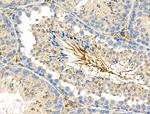 Phospho-FGFR3 (Tyr577) Antibody in Immunohistochemistry (Paraffin) (IHC (P))