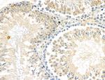 Phospho-FGFR3 (Tyr577) Antibody in Immunohistochemistry (Paraffin) (IHC (P))