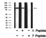 Phospho-FGFR3 (Tyr577) Antibody in Western Blot (WB)