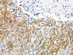 Phospho-FGFR3 (Tyr724) Antibody in Immunohistochemistry (Paraffin) (IHC (P))